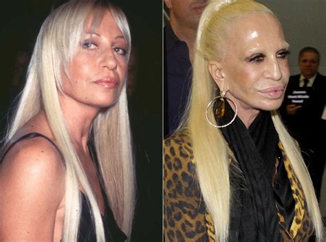 donatella versace before and after.